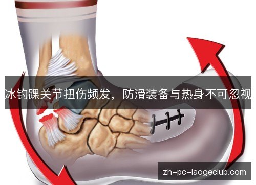 冰钓踝关节扭伤频发，防滑装备与热身不可忽视